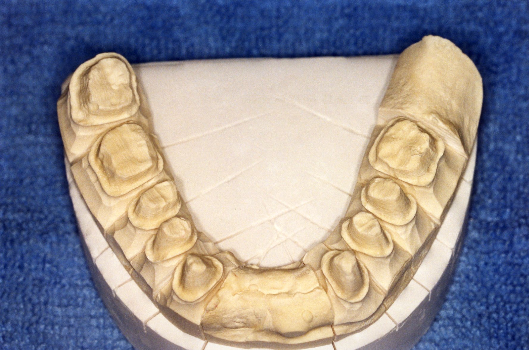 teeth