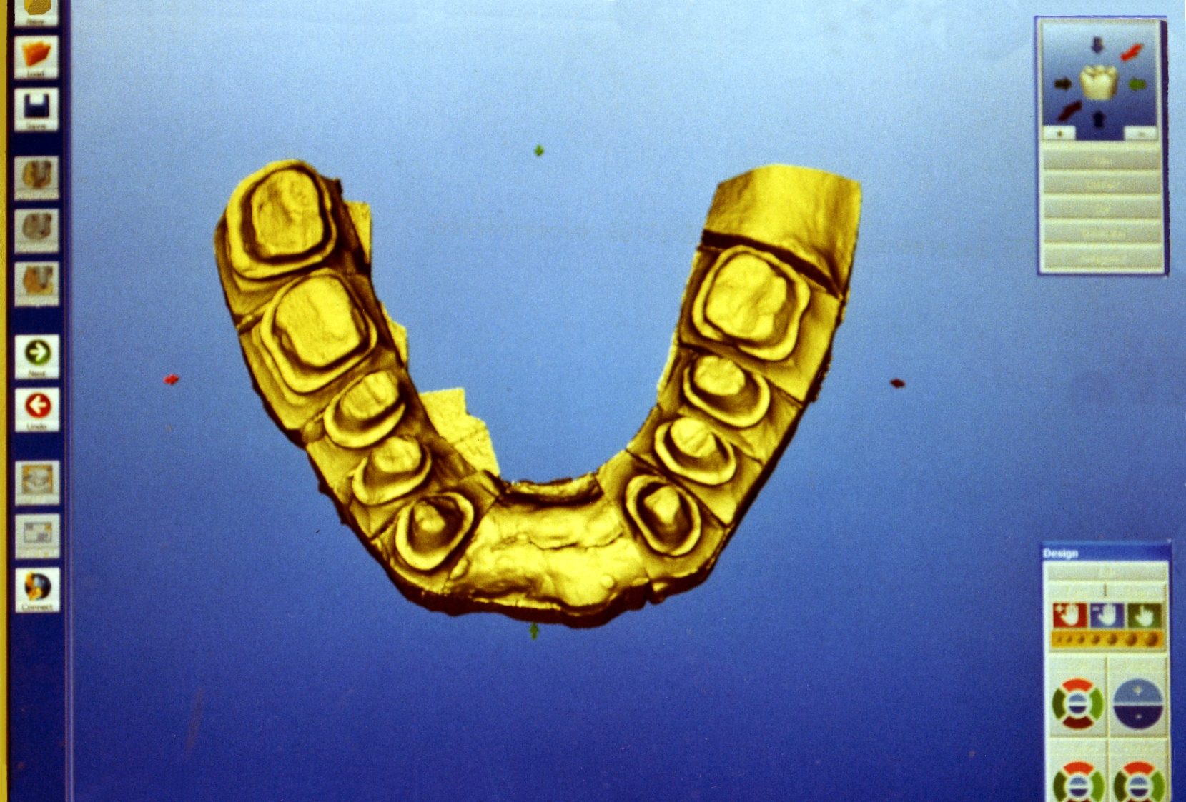 teeth