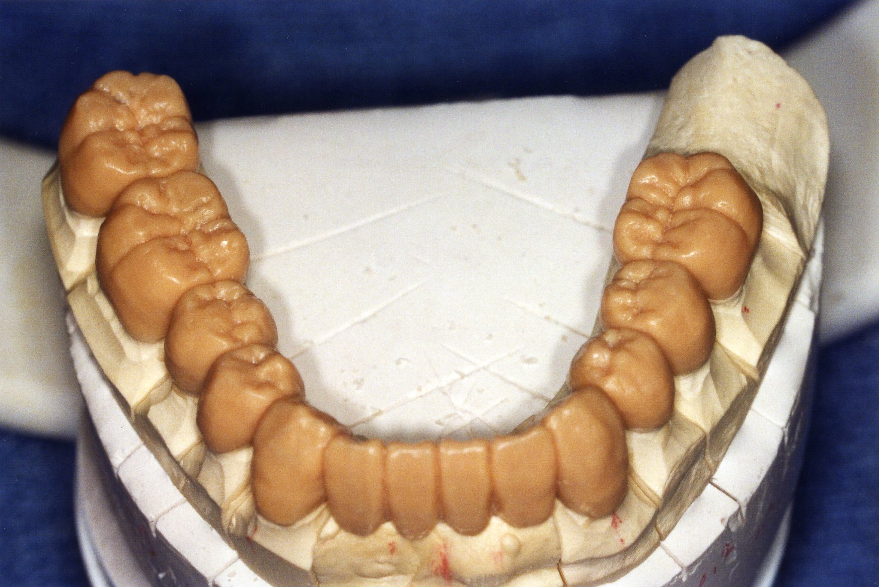 teeth