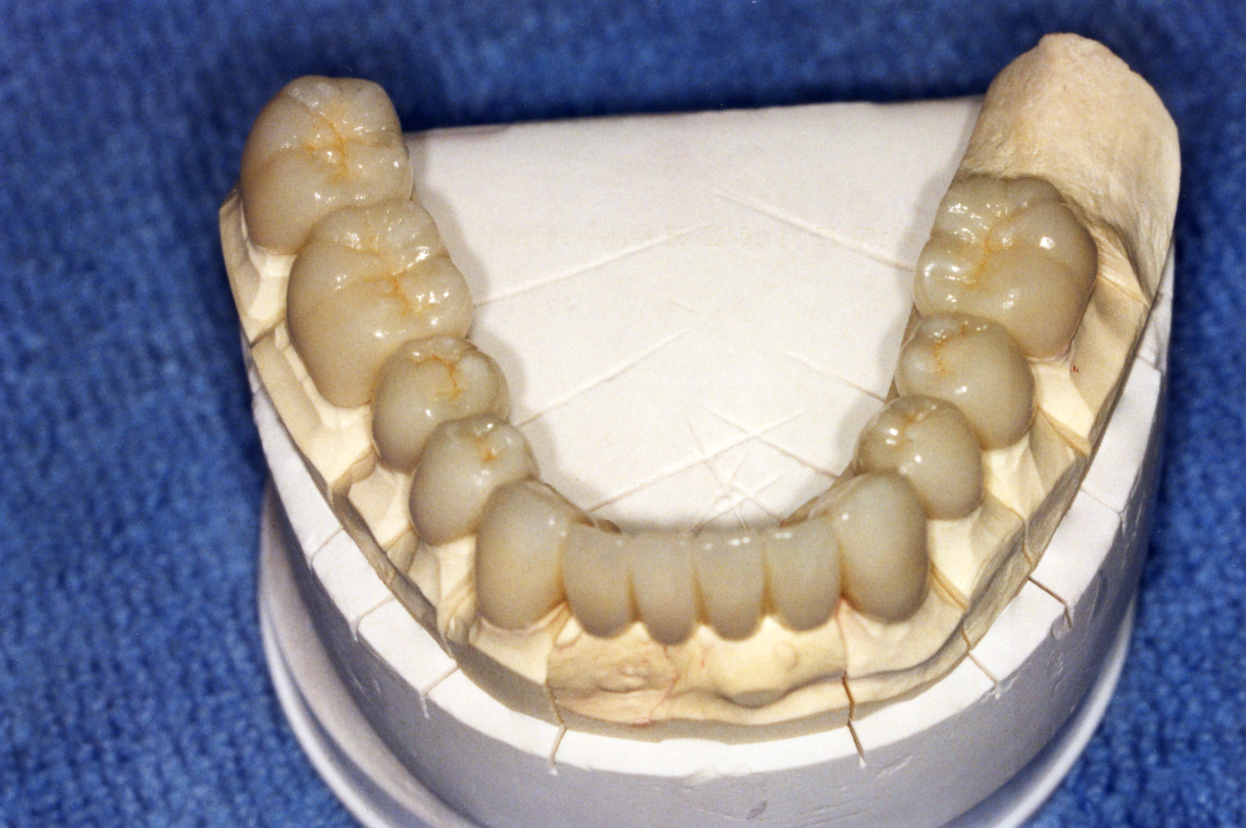 teeth