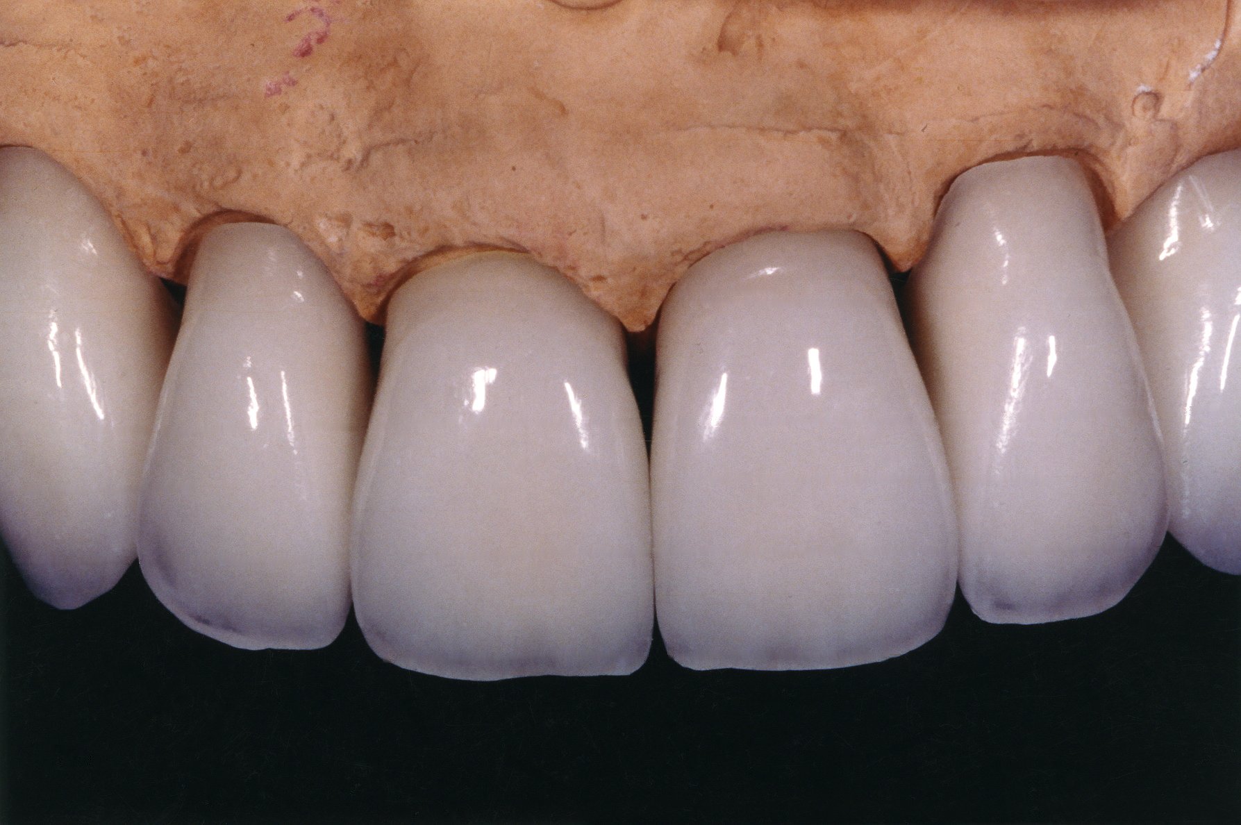 teeth