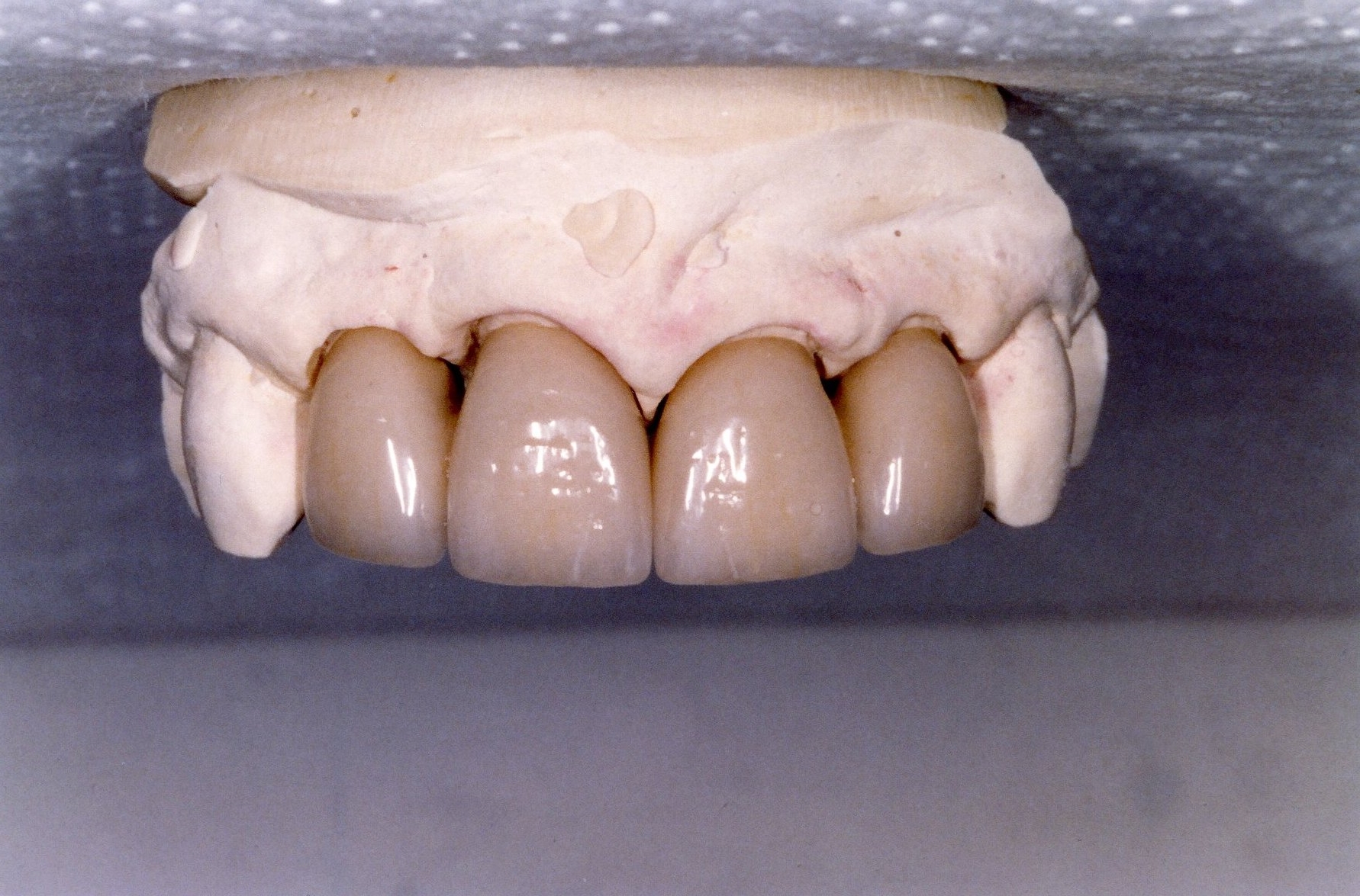 teeth