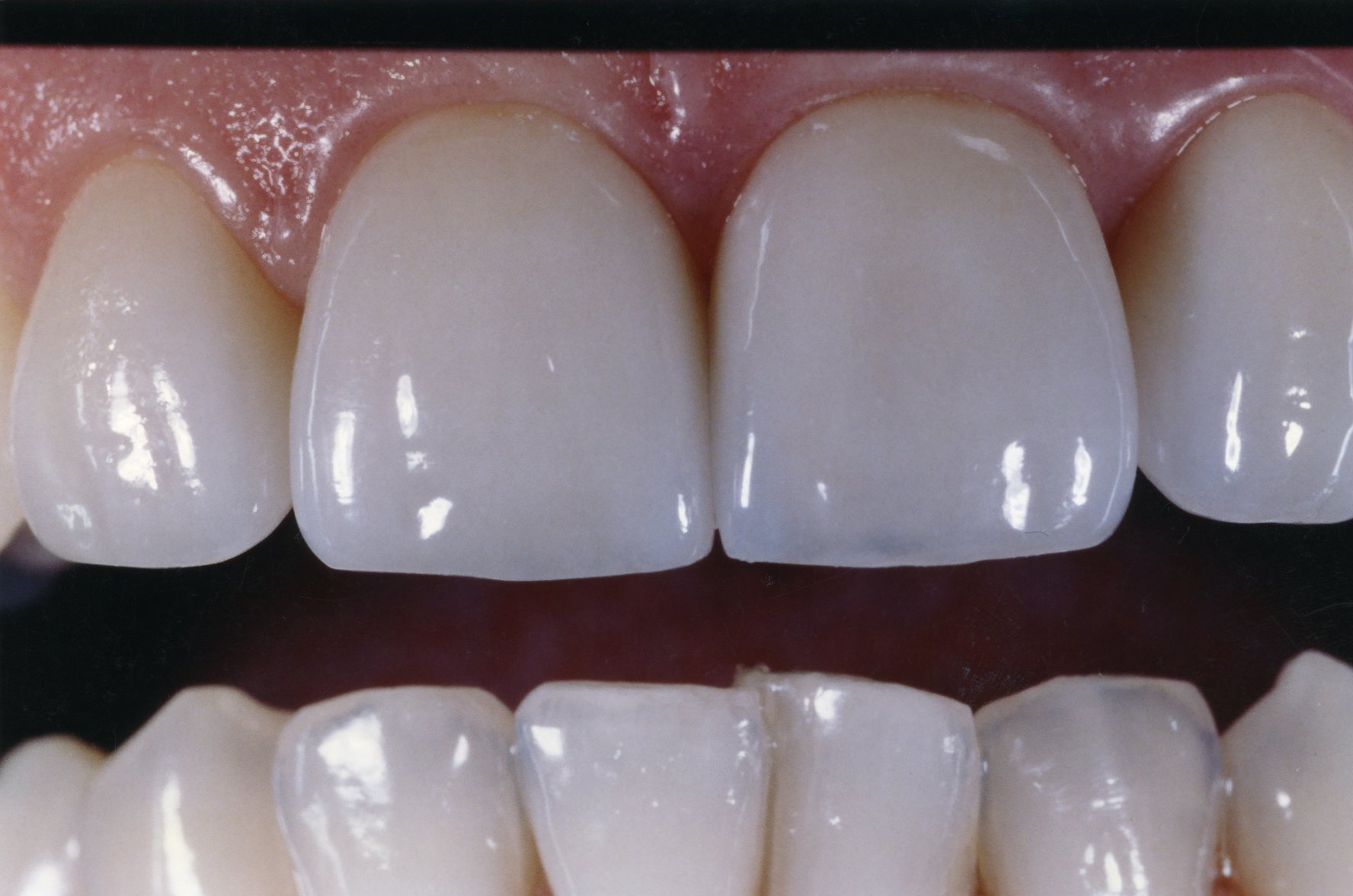 teeth