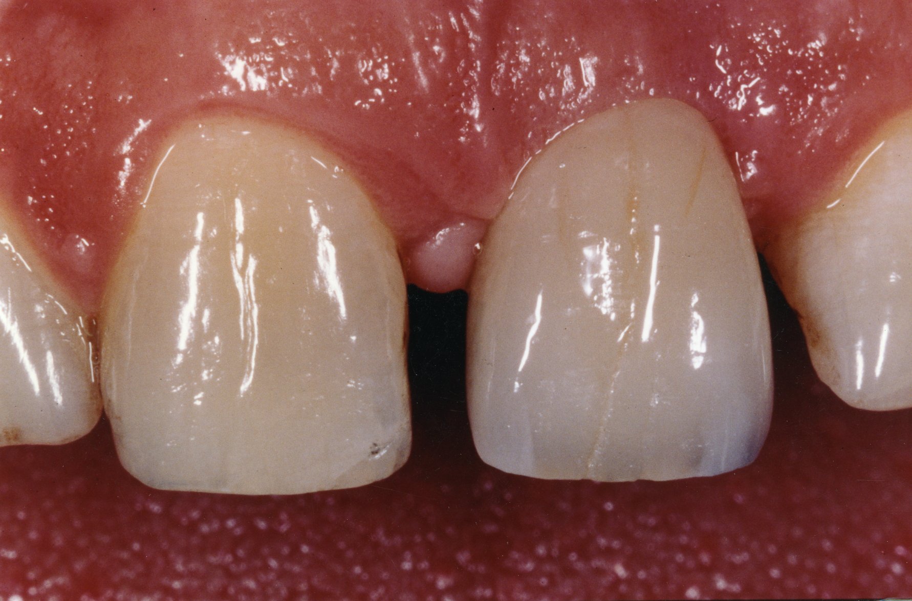 teeth