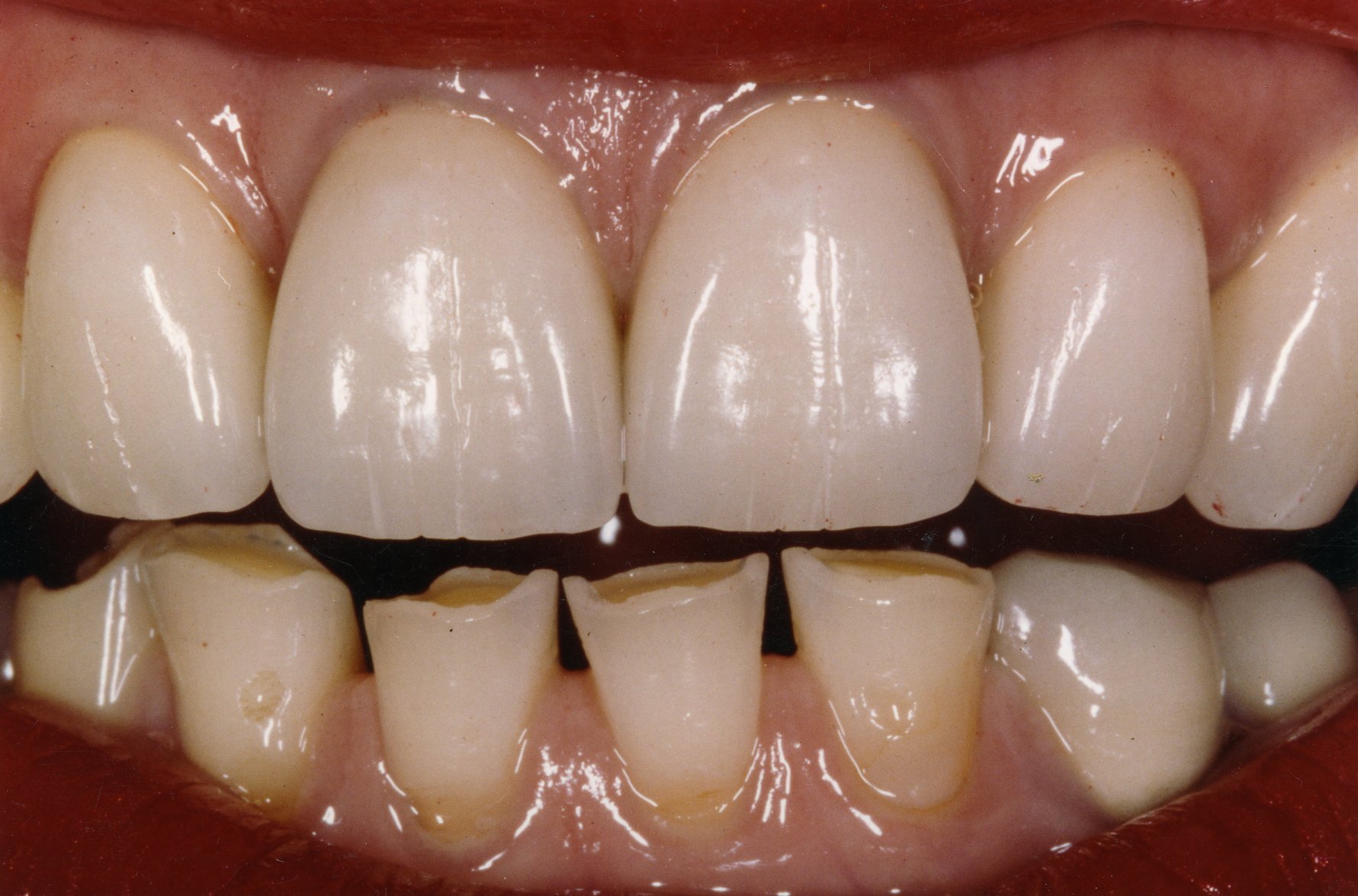 teeth