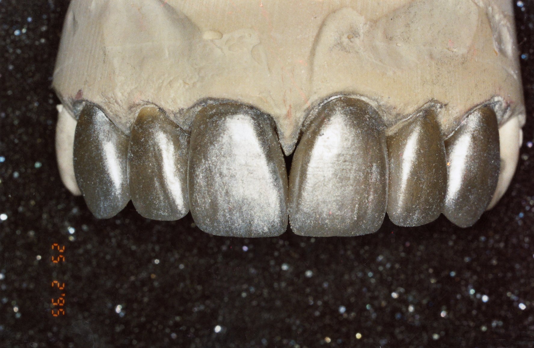 teeth