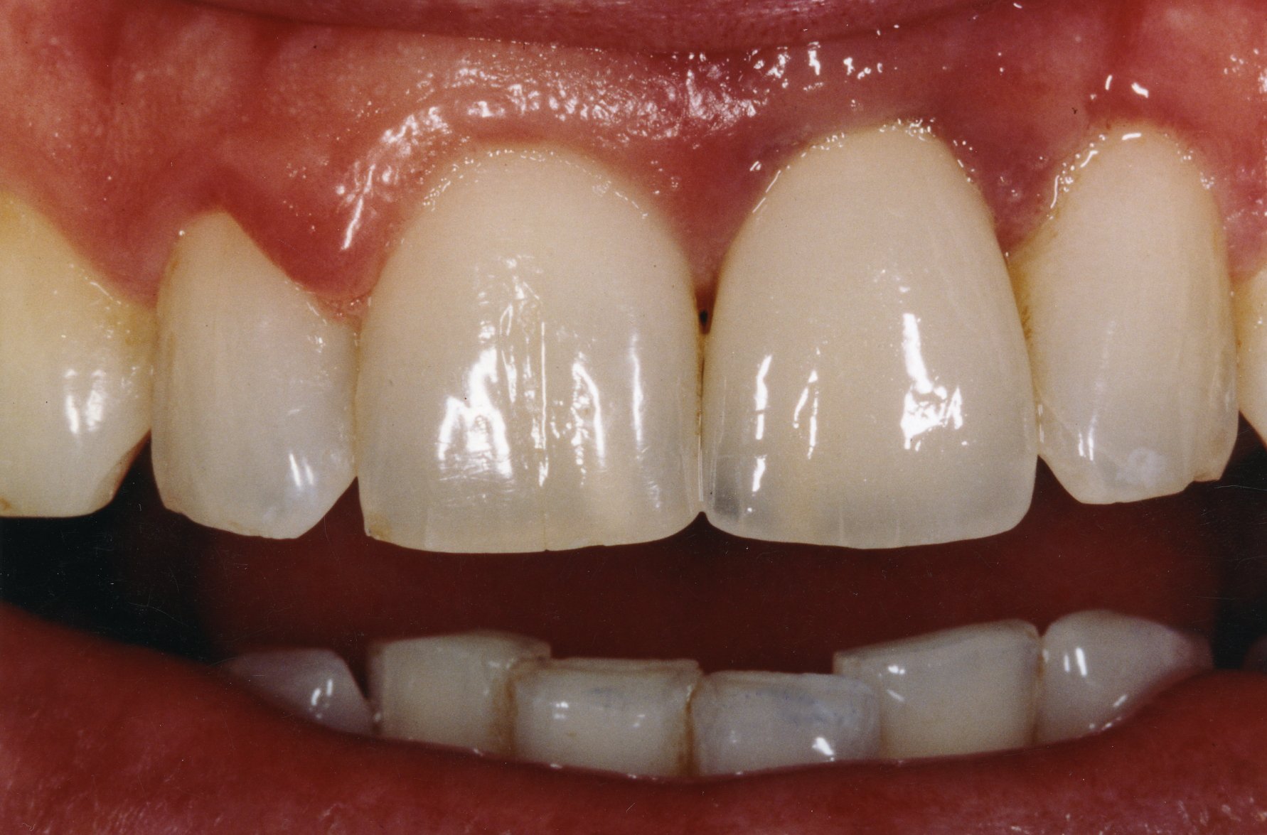 teeth