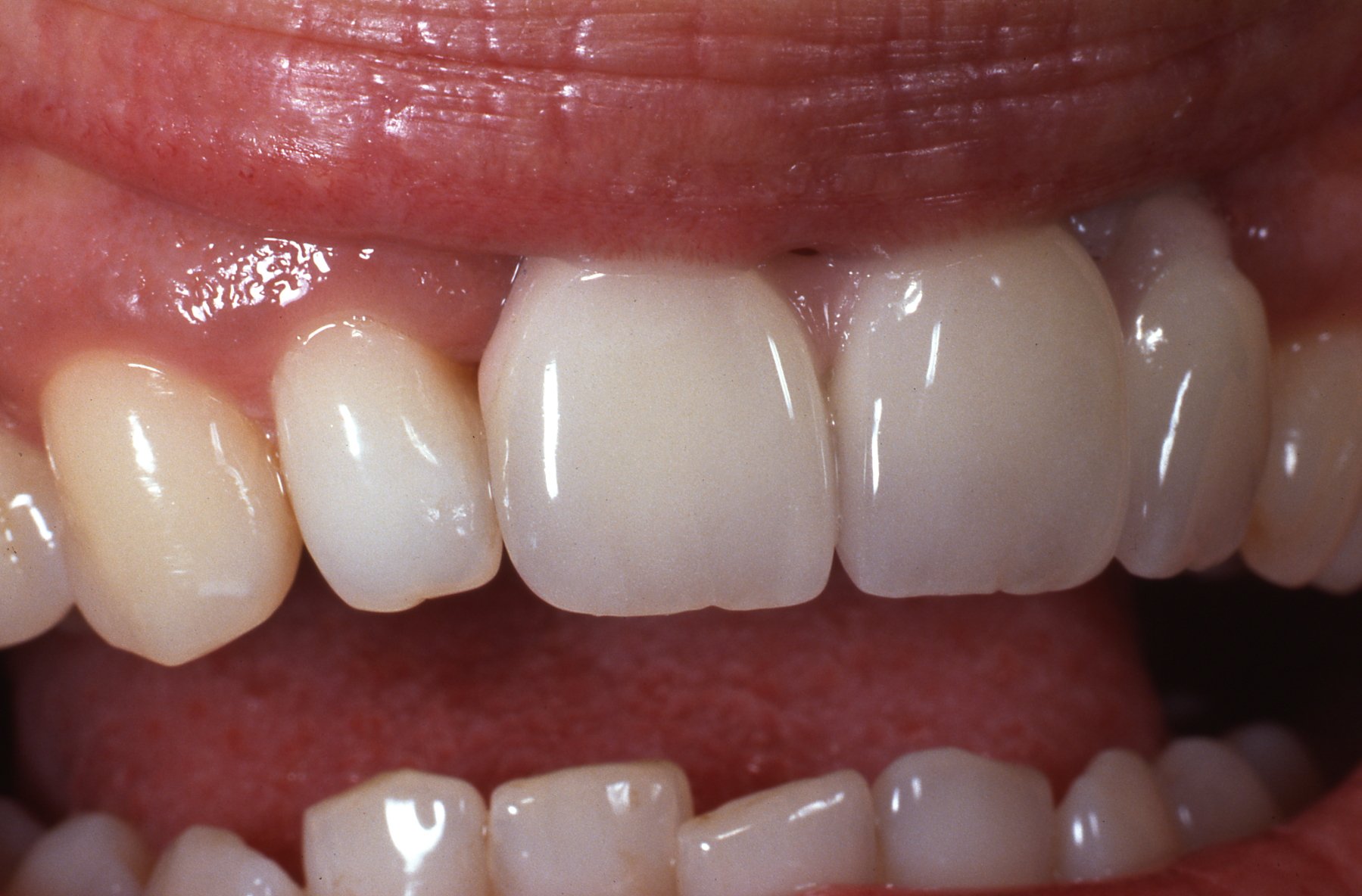 teeth