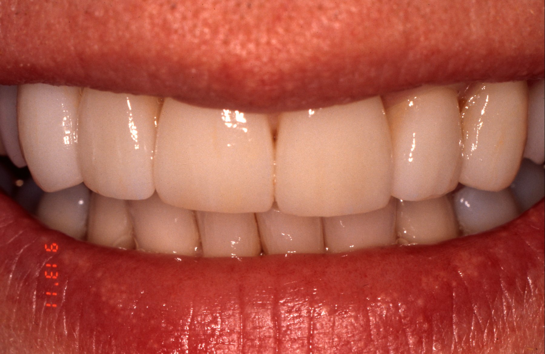 teeth
