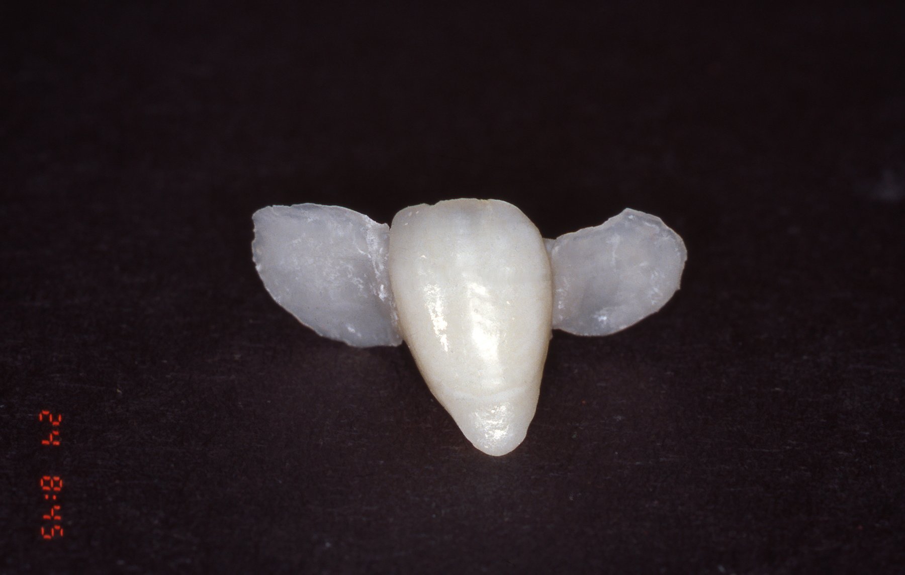 teeth