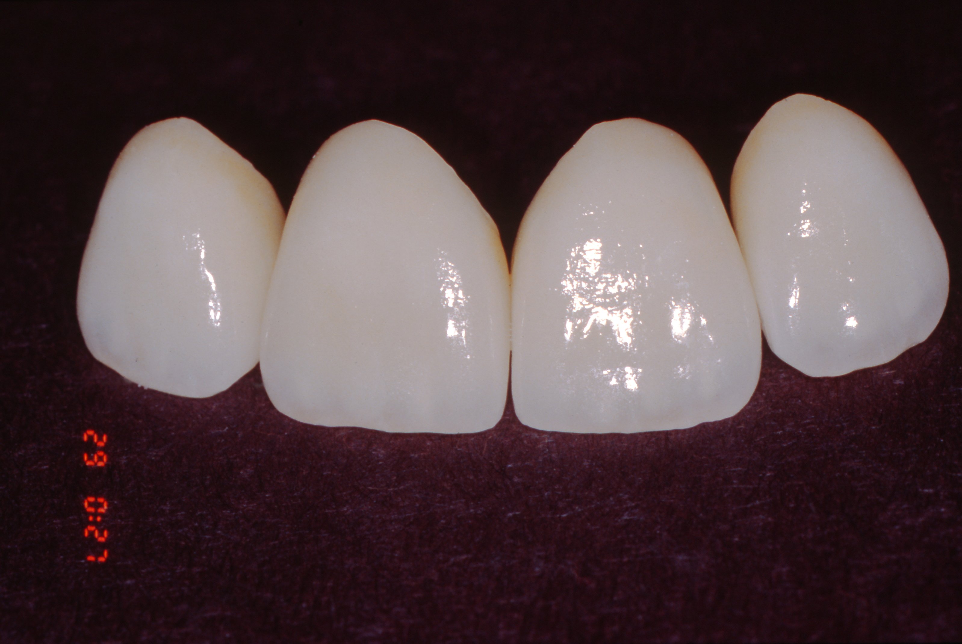 teeth
