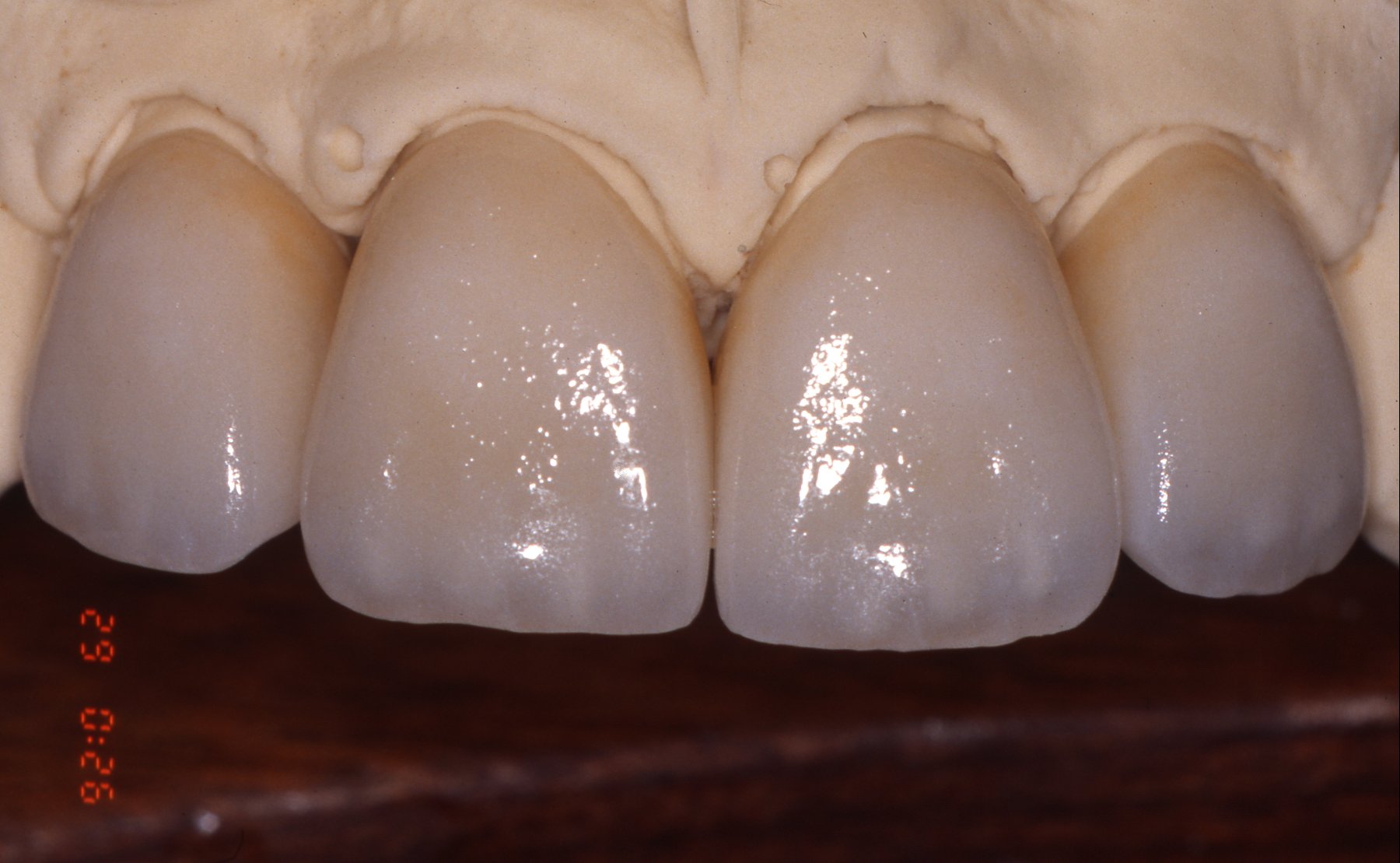 teeth