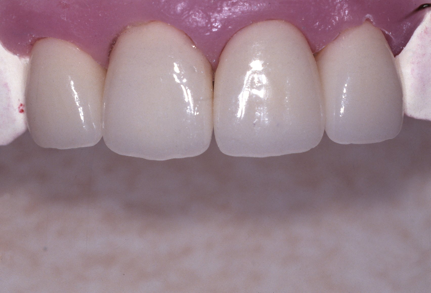 teeth