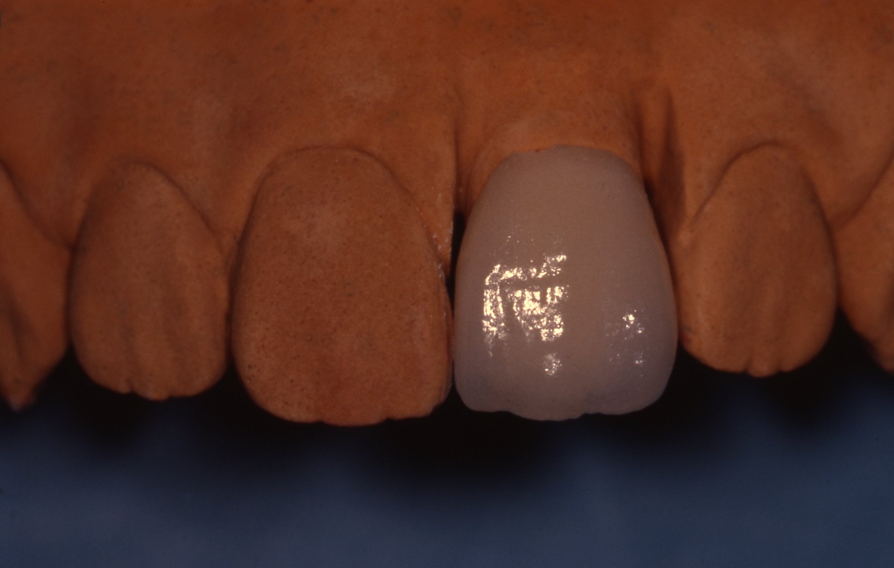 teeth