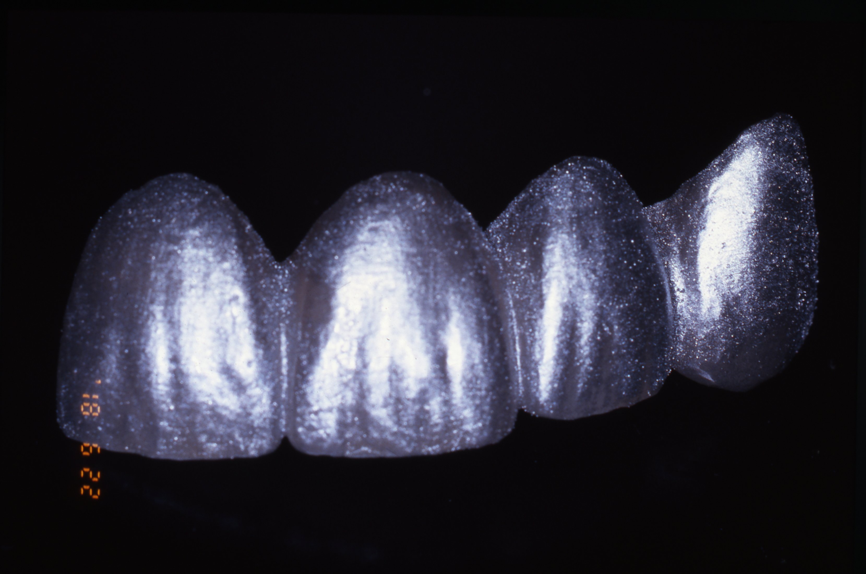 teeth